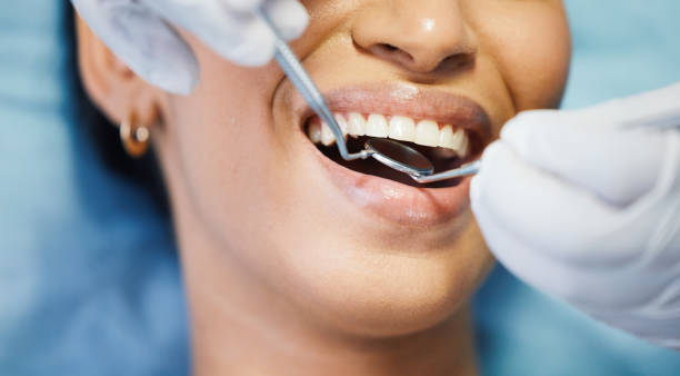 Best Same-Day Emergency Dental Services in Cade, LA