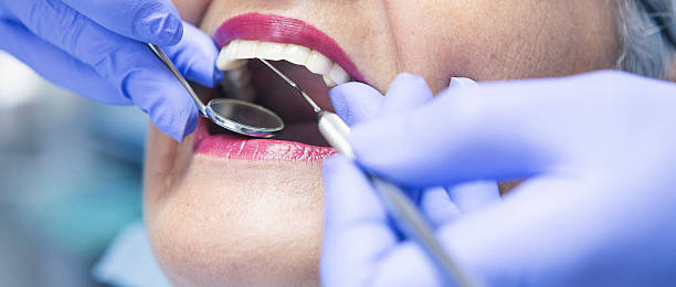 Best Emergency Dental Care for Broken or Chipped Teeth in Cade, LA